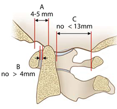 fractura vertebral.png2